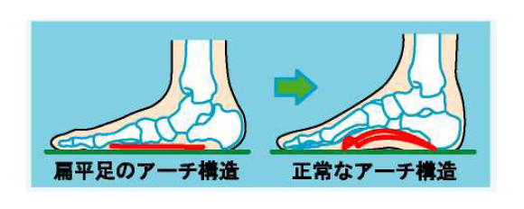O脚矯正 O脚予防に最適なドクターバランス